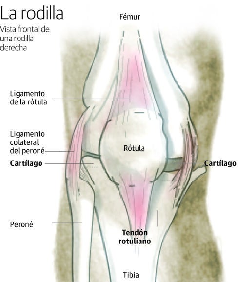 Tipos de lesiones de rodilla